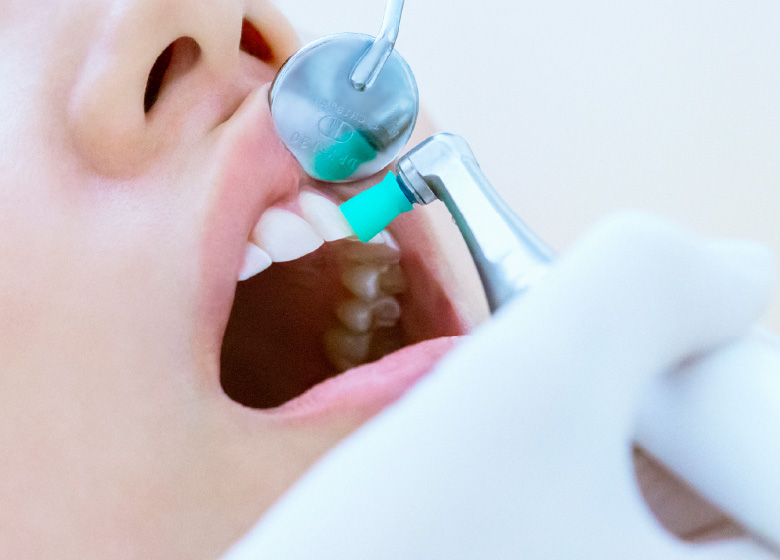 歯のクリーニングの様子